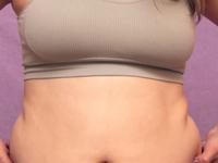 पोट कमीच होत नाहीये? शरीरातलं एक्स्ट्रा फॅट्स घटवण्याच्या ५ टिप्स- सुडौल, कॉन्फिडंट दिसाल - Marathi News | How to Lose Weight Fast in 5 Simple Steps : 5 Ways to Lose Belly Fat and Live a Healthier Life | Latest sakhi Photos at Lokmat.com