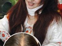 माथ्यावरचे केस पातळ झालेत? केसांचं गळणं पूर्ण थांबवेल शहनाज हुसैनचा उपाय; दाट होतील केस - Marathi News | Shahnaz Hussain's Hair Care Tips : Shahnaz Hussain's Hair Care Tips for long hairs | Latest sakhi Photos at Lokmat.com