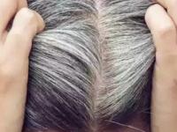 कपाळावरचे केस जास्तच पांढरे दिसून येतात? रोज ५ पदार्थ खा, डाय न लावता काळेभोर होतील केस - Marathi News | Foods For Hair Growth : Top Five Foods for Hair Growth What to eat for hair growth | Latest sakhi Photos at Lokmat.com