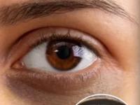 डार्क सर्कल्समुळे चेहरा खूप विचित्र दिसतो? १ सोपा उपाय करा- आठवडाभरातच दिसेल फरक - Marathi News | Home remedies for dark circles, How to get rid of dark circles, quick remedies for dark circles | Latest sakhi Photos at Lokmat.com