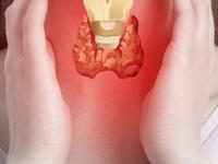 थायरॉईडचा त्रास कमी करणारी ५ योगासनं! सेलिब्रिटी ट्रेनर अंशुका परवानी सांगतात, थायरॉइड कंट्रोल करण्याचा उपाय - Marathi News | anshuka parwani suggests 5 yoga poses that helps to reduce thyroid | Latest sakhi Photos at Lokmat.com