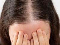 गळणाऱ्या केसांना द्या बायोटीनचा सुपरडोस! ५ पदार्थ खा, केसांच्या सगळ्या तक्रारी संपल्याच समजा.. - Marathi News | 5 biotin rich food for healthy hair, food for stimulating hair growth, home remedies for hair growth, how to stop hair loss | Latest sakhi Photos at Lokmat.com