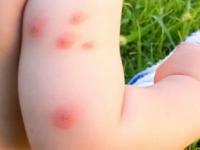 पावसाळ्यात डास वाढले- कडाकड चावतात? 'हे' जादुई पाणी अंगाला लावा, डास चार हात लांब राहतील... - Marathi News | home made Mosquito Repellent oil, how to make Mosquito Repellent oil at home, best remedies to get rid of Mosquitos, how to keep mosquitos away | Latest sakhi Photos at Lokmat.com