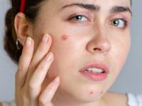 केस वाढतील भराभर- होतील दाट, त्वचाही दिसेल सुंदर- तरुण! खा फक्त ३ पदार्थ रोज - Marathi News | best food for healthy hair and glowing skin, what to eat for long and strong hair and radiant glowing skin | Latest sakhi Photos at Lokmat.com