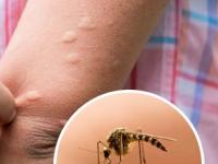 पावसाळ्यात घरभर उडणारे चावरे डास पळवण्याचा भन्नाट उपाय, घरात शोधूनही डास सापडणार नाहीत... - Marathi News | best home remedies to protect from mosquito bite, how to get rid of mosquitos, use of vicks for removing mosquito from house | Latest sakhi Photos at Lokmat.com