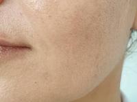 चेहऱ्यावरची चमक गेली- त्वचा डल दिसते? 'हा' उपाय करा- फेशियल केल्यासारखा इंस्टंट ग्लो येईल - Marathi News | how to get instant glowing skin, simple home remedies for the glowing skin, how to remove tanning and dead skin? | Latest sakhi Photos at Lokmat.com