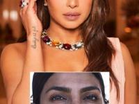 फक्त ५ रुपयांत चेहऱ्यावरचे वांगाचे डाग निघून जातील, १ साेपा उपाय- त्वचा दिसेल स्वच्छ, चमकदार - Marathi News | how to get rid of pigmentation, simple home remedies to reduce pigmentation | Latest sakhi Photos at Lokmat.com