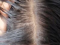 केस खूप गळतात? खोबरेल तेलात २ पदार्थ टाकून मालिश करा, केस वाढतील भराभर- हाेतील दाट - Marathi News | hair care tips for winter, best home remedies for reducing hair fall, how to make dry hair smooth and shiny, best hair oil for fast hair growth | Latest sakhi Photos at Lokmat.com