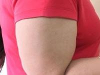 चरबीचे थर साचून दंड खूपच जाडजूड दिसतात? ५ व्यायाम करा- काही दिवसांतच हात दिसतील सुडौल - Marathi News | best exercise to reduce arm fat, how to reduce excess fats on arms? | Latest sakhi Photos at Lokmat.com