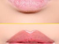 ओठ सतत कोरडे पडणे, ओठांचे साल निघणे हे साधे लक्षण नाही, तुम्हाला असू शकतो 'हा' त्रास - Marathi News | what is the reason for dry, black lips, Why do lips peel constantly? | Latest sakhi Photos at Lokmat.com