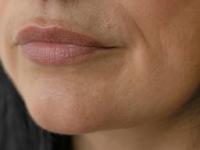 त्वचेचं तारुण्य टिकविण्यासाठी 'या' पद्धतीने वापरा लवंग! वय वाढलं तरी त्वचा सुरकुतणार नाही... - Marathi News | use of clove oil for reducing fine lines or wrinkles, how to get wrinkle free young skin | Latest sakhi Photos at Lokmat.com