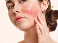 चेहऱ्यावर पिगमेंटेशन, बारीक सुरकुत्या दिसू लागल्या? बटाट्याची सालं 'या' पद्धतीने वापरा, त्वचा तरुण दिसेल - Marathi News | use of potato peel for young glowing skin, skin care tips using potato peel, potato peel face pack for reducing pigmentation | Latest sakhi Photos at Lokmat.com