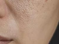 गालांवर खूप ओपन पोअर्स असल्याने चेहरा थोराड दिसतो? ५ टिप्स- त्वचा होईल नितळ- स्वच्छ - Marathi News | 5 tips to reduce open pores, how to get rid of open pores, skin care tips to hide open pores, home hacks to reduce visible pores | Latest sakhi Photos at Lokmat.com