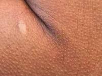 अंगावर शहारा येण्याचे शास्त्रीय कारण जाणून घ्या... शहारा येतो कारण.. - Marathi News | Know the scientific reason behind the goosebumps | Latest sakhi Photos at Lokmat.com