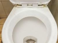 टॉयलेट सीटवर पडलेले पिवळे डाग २ मिनिटांत निघून जातील! 'हा' पदार्थ वापरून करा स्वच्छता - Marathi News | how to clean yellow stains on toilet seat, simple home hacks to clean toilet stains | Latest sakhi Photos at Lokmat.com