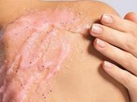 अंगावर आलेली पुरळ गायब करणारे ५ स्क्रब, खाज-जळजळ-लाली यांची चिंताच विसरा - Marathi News | 5 scrubs that will make your acne disappear, forget about itching, burning, and redness | Latest sakhi Photos at Lokmat.com