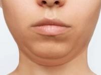 चेहरा भप्प जाडजूड दिसतो? चेहऱ्यावरची चरबी घटवण्याचे पाहा ६ सोपे उपाय, डबल चीन गायब - Marathi News | Does your face look too fat? See 6 easy ways to reduce facial fat | Latest sakhi Photos at Lokmat.com