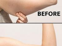 थुलथुलीत जाडजूड दंड सुडौल करणारे ७ सोपे उपाय! दंड विचित्र दिसतात म्हणून नाराज नका होऊ.. - Marathi News | 7 easy ways to make your thick, chubby arms look slimmer | Latest sakhi Photos at Lokmat.com