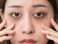 डार्क सर्कल्समुळे ऐन तारुण्यात म्हातारे- थकलेले दिसता? ६ उपाय- काळी वर्तुळे होतील गायब - Marathi News | 6 tips for reducing dark circles, how to get rid of dark circles, simple home remedies to get rid of dark circles, causes or reasons for dark circles | Latest sakhi Photos at Lokmat.com