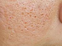 ओपन पोर्समुळे चेहरा म्हातारा-उदास दिसतो? ७ नैसर्गिक पदार्थ लावा, चेहऱ्यावर येईल तरुण चमक... - Marathi News | 7 Natural Exfoliators To Minimize Pores Without Drying Skin 7 Natural Exfoliators to Minimize Pores Without Drying Skin How to get rid of large pores | Latest sakhi Photos at Lokmat.com