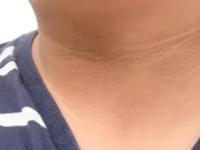 मळ साचून मुलांची मान, हाताचे कोपरे काळे पडले? १ सोपा उपाय- ५ मिनिटांत दिसतील स्वच्छ - Marathi News | how to remove tanning, dead skin from neck, knee and elbow? how to clean blackness on kids neck and knees? | Latest sakhi Photos at Lokmat.com