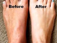 हात- पाय काळे पडले? घ्या मस्त उपाय- घरच्याघरी फुकटात मिळेल पेडिक्युअर- मेनिक्युअरसारखा इफेक्ट - Marathi News | how to get rid of blackness from hands and leg, simple trick to remove tanning and dead skin from hands and leg, how to do manicure and pedicure at home? | Latest sakhi Photos at Lokmat.com