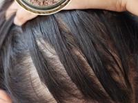 केस गळणं, कोंडा आणि पांढरे केस! तिन्ही समस्यांवर हमखास उपाय आहे 'हा' शाम्पू- वापरून पाहा.. - Marathi News | best herbal shampoo for controlling hair fall, dandruff and gray hair, home made shampoo for long, strong and healthy hair | Latest sakhi Photos at Lokmat.com