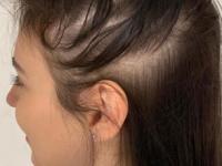 डाेक्यावरचे केस गळाल्याने कपाळ खूप मोठं दिसतं? जास्वंदाच्या पानाफुलांचा हा उपाय- केस वाढतील भराभर - Marathi News | use of jaswand flower for reducing hair fall, how to control hair loss, home hacks for fast hair growth, hair care tips for long and strong hair | Latest sakhi Photos at Lokmat.com