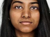 फेशियल, क्लिनअप करूनही चेहरा काळवंडलेलाच? 'या' व्हिटॅमिन्सचे पदार्थ खा, त्वचा होईल तुकतुकीत - Marathi News | deficiency of which vitamin causes symptoms and treatment darkening of the face | Latest sakhi Photos at Lokmat.com