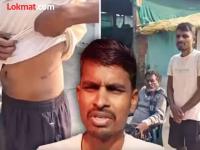 Chandrapur Farmer : किडनी वीक पण कर्ज फेड ! सावकाराच्या सांगण्यावरून शेतकऱ्याने ८ लाखांना विकली किडनी; कंबोडियात जाऊन केले ऑपेरेशन - Marathi News | Sell Kidney but pay my debt ! Farmer sells kidney for 8 lakhs on moneylender's advice; goes to Cambodia for surgery | Latest chandrapur News at Lokmat.com Chandrapur Farmer : किडनी वीक पण कर्ज फेड ! सावकाराच्या सांगण्यावरून शेतकऱ्याने ८ लाखांना विकली किडनी; कंबोडियात जाऊन केले ऑपेरेशन - Marathi News | Sell Kidney but pay my debt ! Farmer sells kidney for 8 lakhs on moneylender's advice; goes to Cambodia for surgery | Latest chandrapur News at Lokmat.com