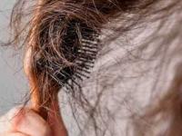 बापरे! हिवाळ्यात 'या' छोट्या चुकांमुळे वेगाने गळू लागतात केस, टक्कल पडण्याची वाटते भीती - Marathi News | what mistakes cause hair fall rapidly in the winter | Latest sakhi Photos at Lokmat.com