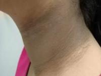 चेहरा गोरा, पण मान खूपच काळवंडली? ३ पदार्थ मानेवर चोळा, १० मिनिटांत मान स्वच्छ - Marathi News | how to get rid of dark neck, home hacks to clean dark neck, tips and tricks to clean dark neck | Latest sakhi Photos at Lokmat.com