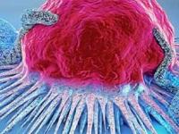 कॅन्सर वाढण्यापासून रोखतात रोजच्या जेवणातले ७ पदार्थ; ताटात असायलाच हवेत - Marathi News | 7 Foods That Prevent From Cancer : Which Food Items Prevent From Cancer | Latest sakhi Photos at Lokmat.com