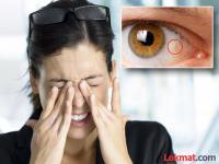 हा आजार वेळेवरच ओळखा; नाहीतर डोळ्यांत इंजेक्शन देण्याची येईल वेळ! - Marathi News | Identify this disease on time; otherwise it will be time to give injections in the eyes! | Latest maharashtra Photos at Lokmat.com