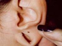 कानाचं छिद्र खूपच मोठे झाले? ६ उपाय- ओघळलेल्या कानांतही सुंदर दिसतील कानातले - Marathi News | How To Reduce Ear Holes : How To Reduce Ear Hole Size Naturally At Home | Latest sakhi Photos at Lokmat.com