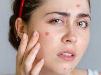 चुकूनही चेहऱ्याला लावू नका 'हे' पदार्थ, त्वचा खराब होऊन ऐन तारुण्यातच दिसाल म्हाताऱ्या - Marathi News | avoid 5 products that may cause harm to your skin, don't apply these products on your skin, cosmetics or home hacks that can cause skin damage | Latest sakhi Photos at Lokmat.com