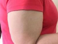 दंड खूप जाडजुड झाले? ४ टिप्स, जीमला न जाताही दंडावरची चरबी कमी होईल, हात दिसतील नाजुक - Marathi News | 4 exercises to reduce arm fat, how to get rid of arm fat, home hacks to reduce arm fat | Latest sakhi Photos at Lokmat.com