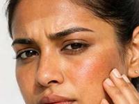 उन्हात गाडीवर फिरल्याने हात, कपाळ काळवंडून गेलं? बघा टॅनिंग कमी करणारे २ झटपट उपाय - Marathi News | how to get rid of tanned skin in summer? home hacks for removing tanning, how to remove tanning | Latest sakhi Photos at Lokmat.com