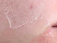 ६ घरगुती पदार्थ चेहऱ्यावर आणतात आठवडाभरात तेज, थंडीत त्वचाही राहते मऊमुलायम! कशाला आणता महागड्या क्रिम्स... - Marathi News | home remedies for dry skin natural moisturizer for dry skin dry skin care tips | Latest sakhi Photos at Lokmat.com