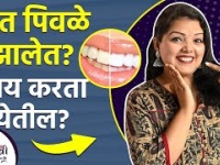 २ मिनिटांत दातांचा पिवळेपणा दूर करा | How to Whiten Your Teeth at Home in 2 Minutes |Teeth Whitening