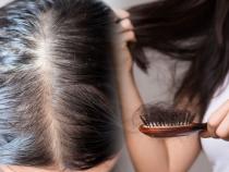 Hair Fall Stop Solution : केस खूपच गळतात? आजपासूनच ५ पदार्थ खाणं सोडा, अन्यथा टक्कल कधी पडेल कळणारही नाही - Marathi News | Hair Fall Stop Solution : Hair fall baldness risk Hair Fall Stop Solution : केस खूपच गळतात? आजपासूनच ५ पदार्थ खाणं सोडा, अन्यथा टक्कल कधी पडेल कळणारही नाही - Marathi News | Hair Fall Stop Solution : Hair fall baldness risk