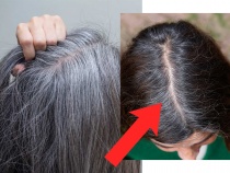 ऐन तारुण्यात केस पांढरे होण्याची ४ कारणं आणि ३ उपाय- वाचा तज्ज्ञांचा सल्ला  - Marathi News | Reasons for gray hair in early age, solutions for white  hair, home remedies for gray