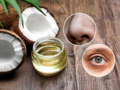 खोबरेल तेलाचे ५ ब्यूटी हॅक्स! 'असं' वापरा चमचाभर तेल, ब्लॅकहेड्सपासून पिवळ्या दातांपर्यंत अनेक समस्यांवर गुणकारी...
