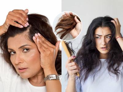 कमी वयात केस पांढरे आणि पातळ झाले? बघा उपाय- केसांच्या सगळ्याच तक्रारी संपून जातील