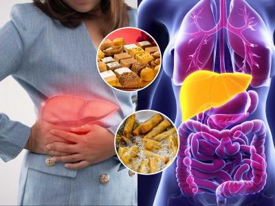 फक्त 'या' ५ प्रकारच्या पदार्थांना कायमच करा गुडबाय! फॅटी लिव्हरचा त्रास होणारच नाही...