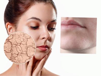 थंडीमुळे त्वचा कोरडी, भुरकट दिसतेय? रात्री झोपताना किचनमधले ४ पदार्थ लावा- त्वचा मऊ, चमकदार होईल