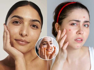 टॅनिंगपासून ब्लॅकहेड्सपर्यंत.. सगळ्या समस्यांवर खास घरगुती उपाय, त्वचा सोन्यासारखी चमकेल