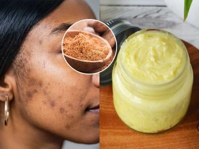 जायफळाचं होममेड क्रिम, रोज रात्री चेहऱ्याला लावा- त्वचेवर एकही डाग राहणार नाही, सौंदर्य खुलतच जाईल