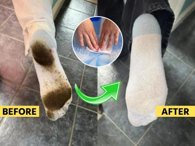 मळलेले पांढरे मोजे-शर्टची काळीकुट्ट कॉलर धुण्याची भन्नाट ट्रिक, ब्रशने घासायला नकोच-पाहा उपाय