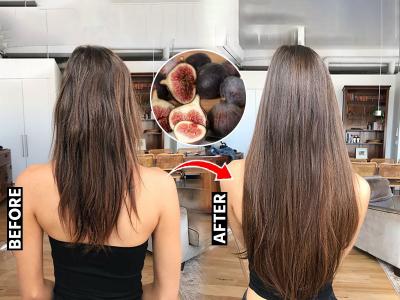 केस गळून टक्कल पडण्याची वेळ आली? ७ पदार्थ खायला लगेच सुरुवात करा, केस गळणं थांबेल